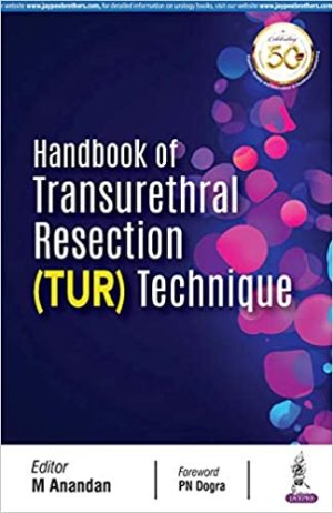 Handbook of Transurethral Resection