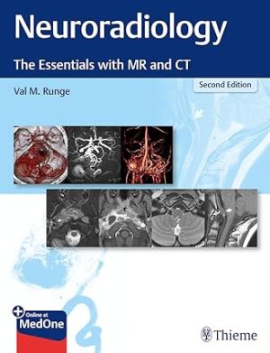 Neuroradiology The Essentials with MR and CT 2nd Edition