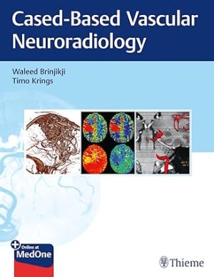 Imaging in Neurovascular Disease A Case Based Approach