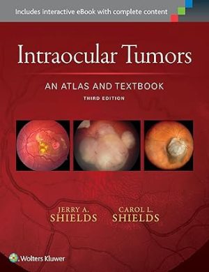 Intraocular Tumors An Atlas and Textbook