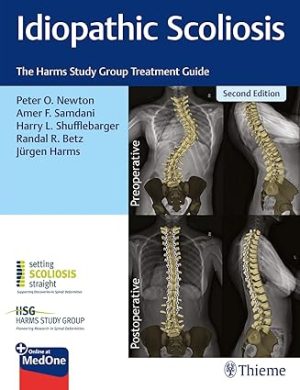 Idiopathic Scoliosis The Harms Study Group Treatment Guide 2nd Edition
