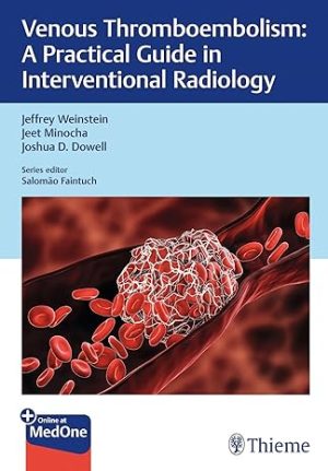 Venous Thromboembolism A Practical Guide in Interventional Radiology