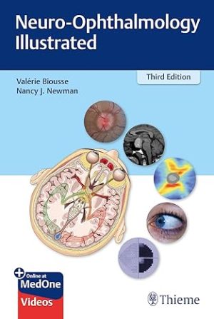 Neuro Ophthalmology Illustrated 3rd Edition